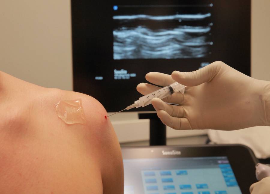 Ultrasound-guided injection for the diagnosis and treatment of